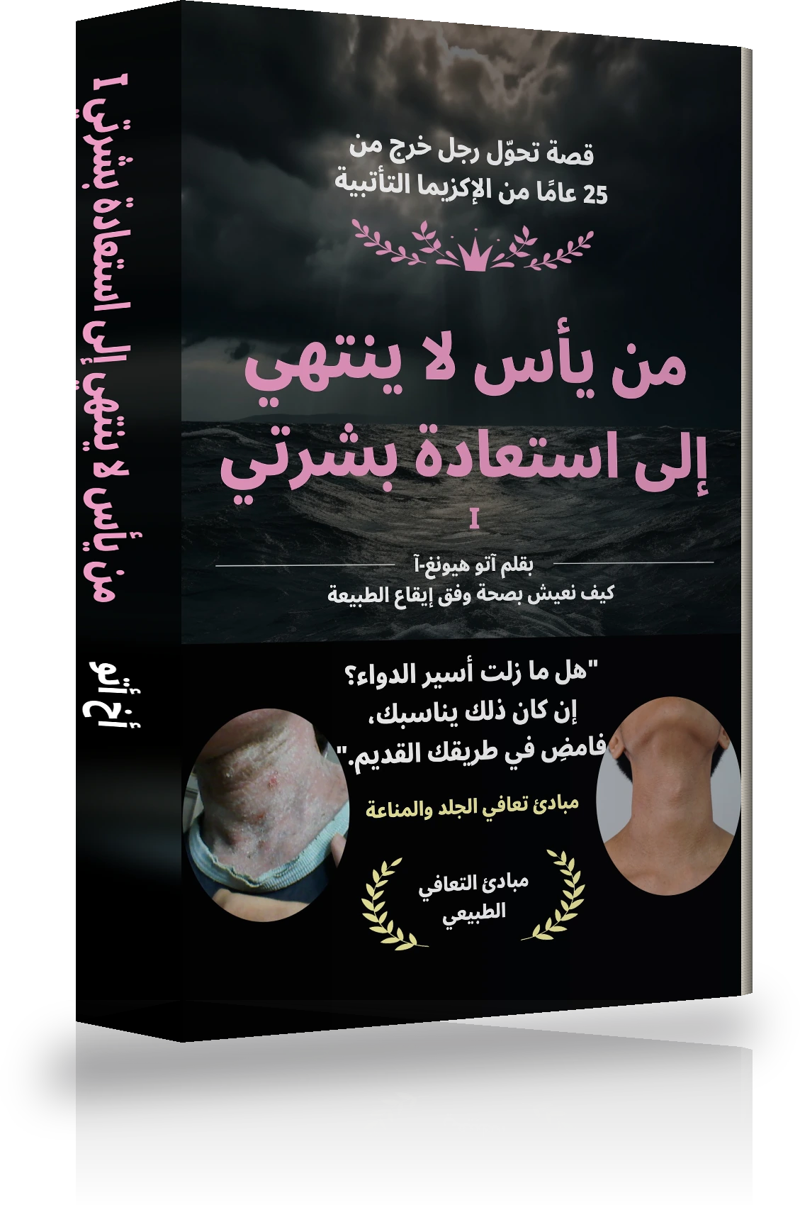 غلاف «من اليأس اللانهائي إلى الشفاء التام من الأكزيما Ⅰ»