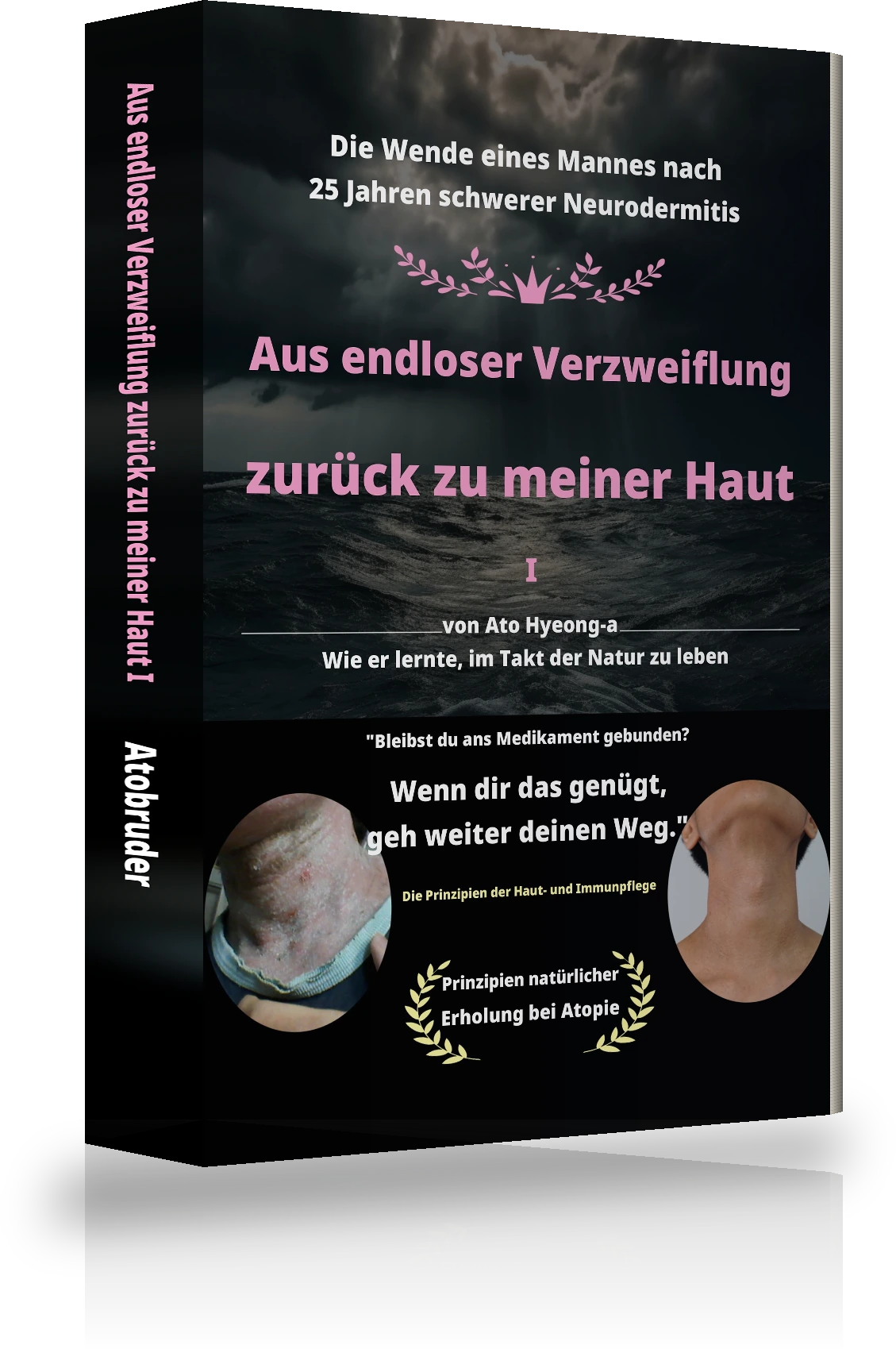 Cover von „Von endloser Verzweiflung bis zur Überwindung der Atopie Ⅰ“