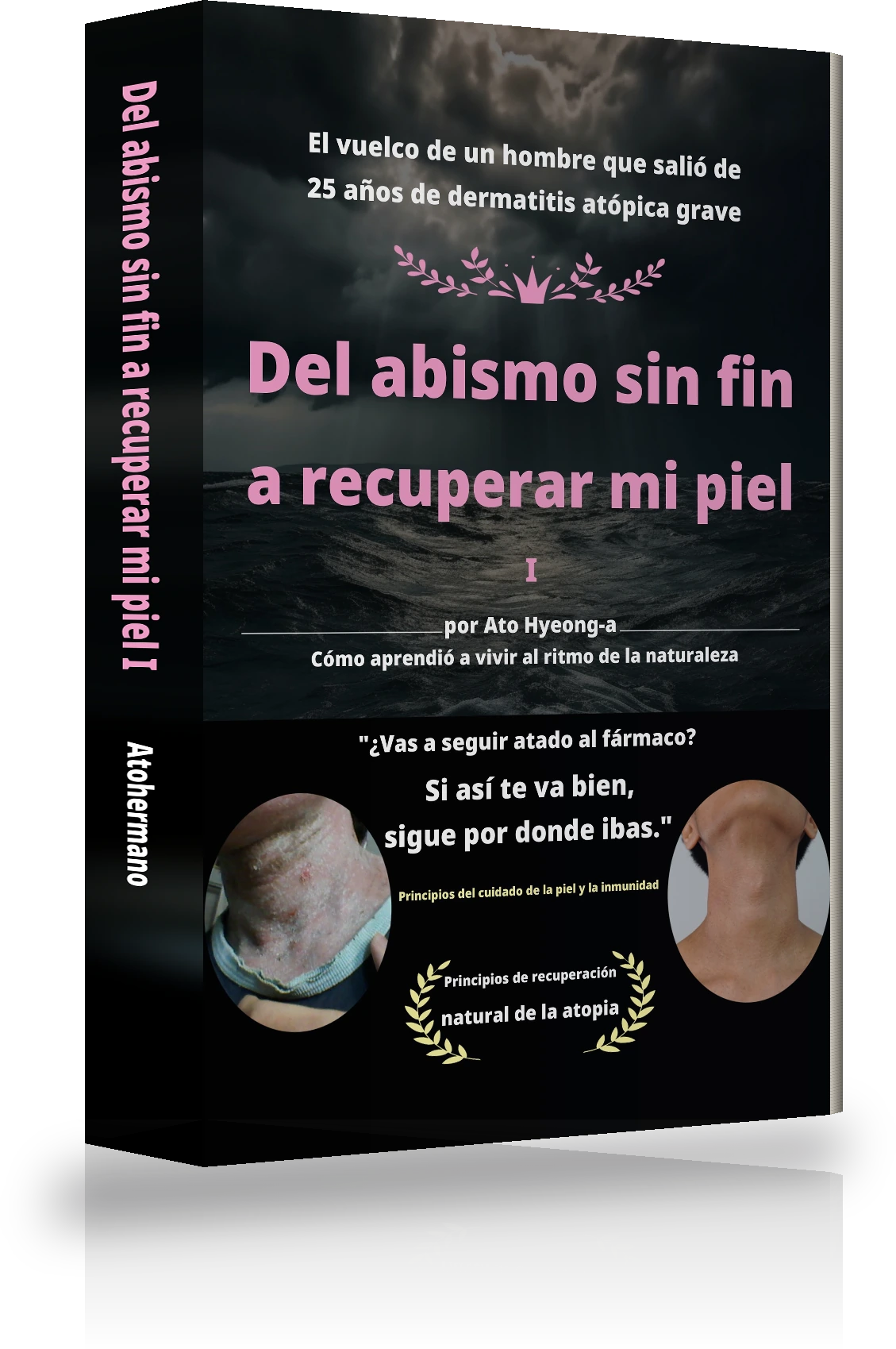 Portada de «De la desesperación sin fin a curar la atopia Ⅰ»