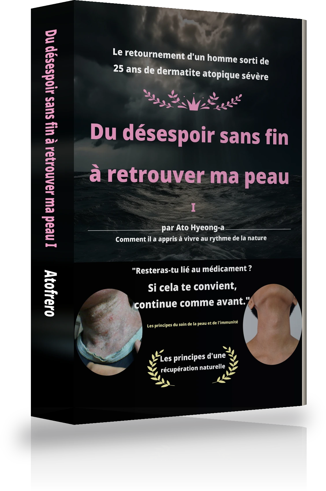 Couverture de « Du désespoir sans fin à la guérison de l'atopie Ⅰ »