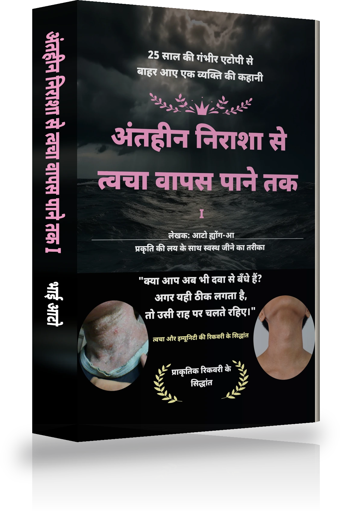 अंतहीन निराशा से एटोपी के पूर्ण इलाज तक Ⅰ का कवर