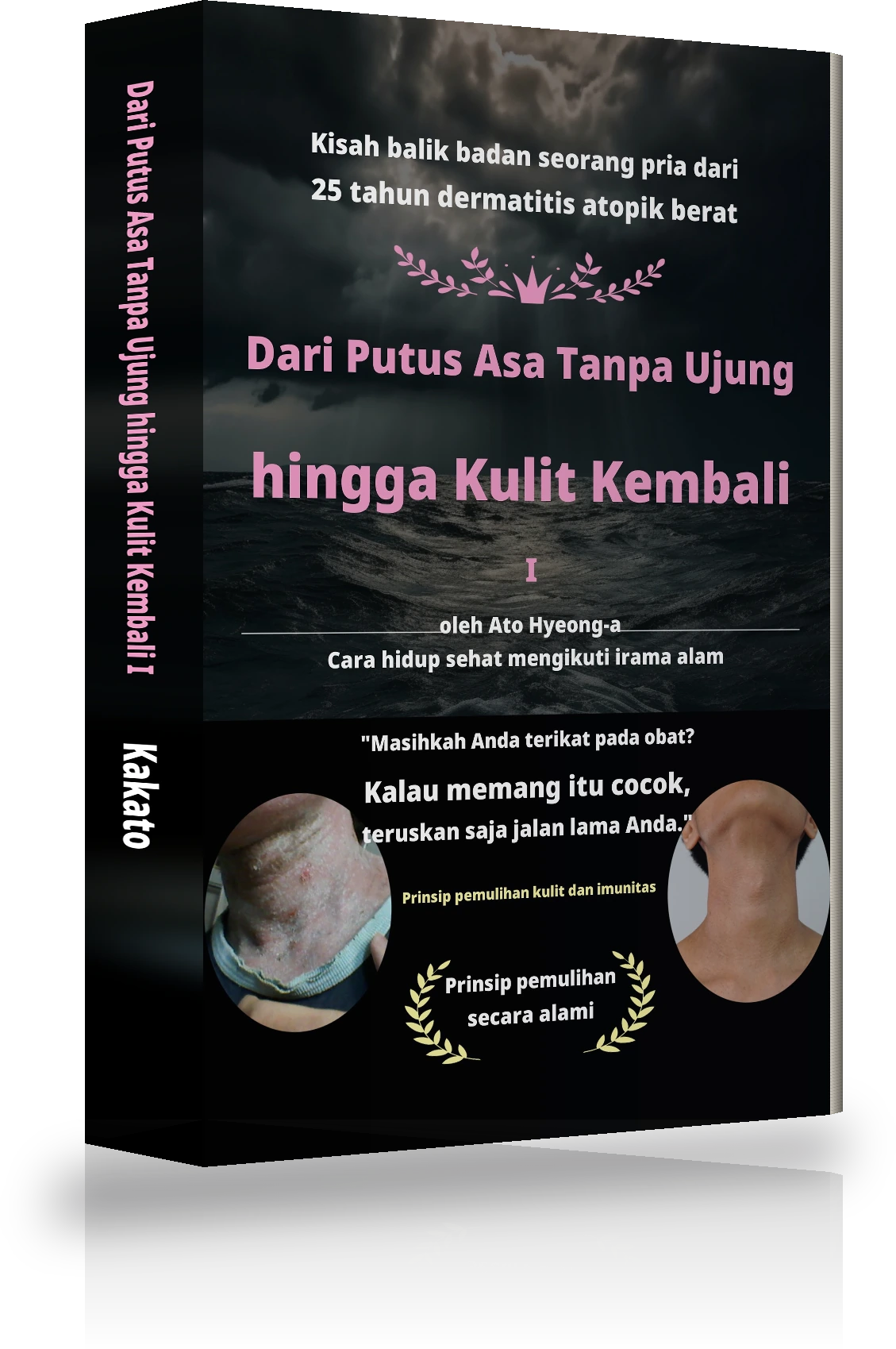 Sampul Dari Keputusasaan Tanpa Akhir hingga Sembuh Total dari Atopi Ⅰ