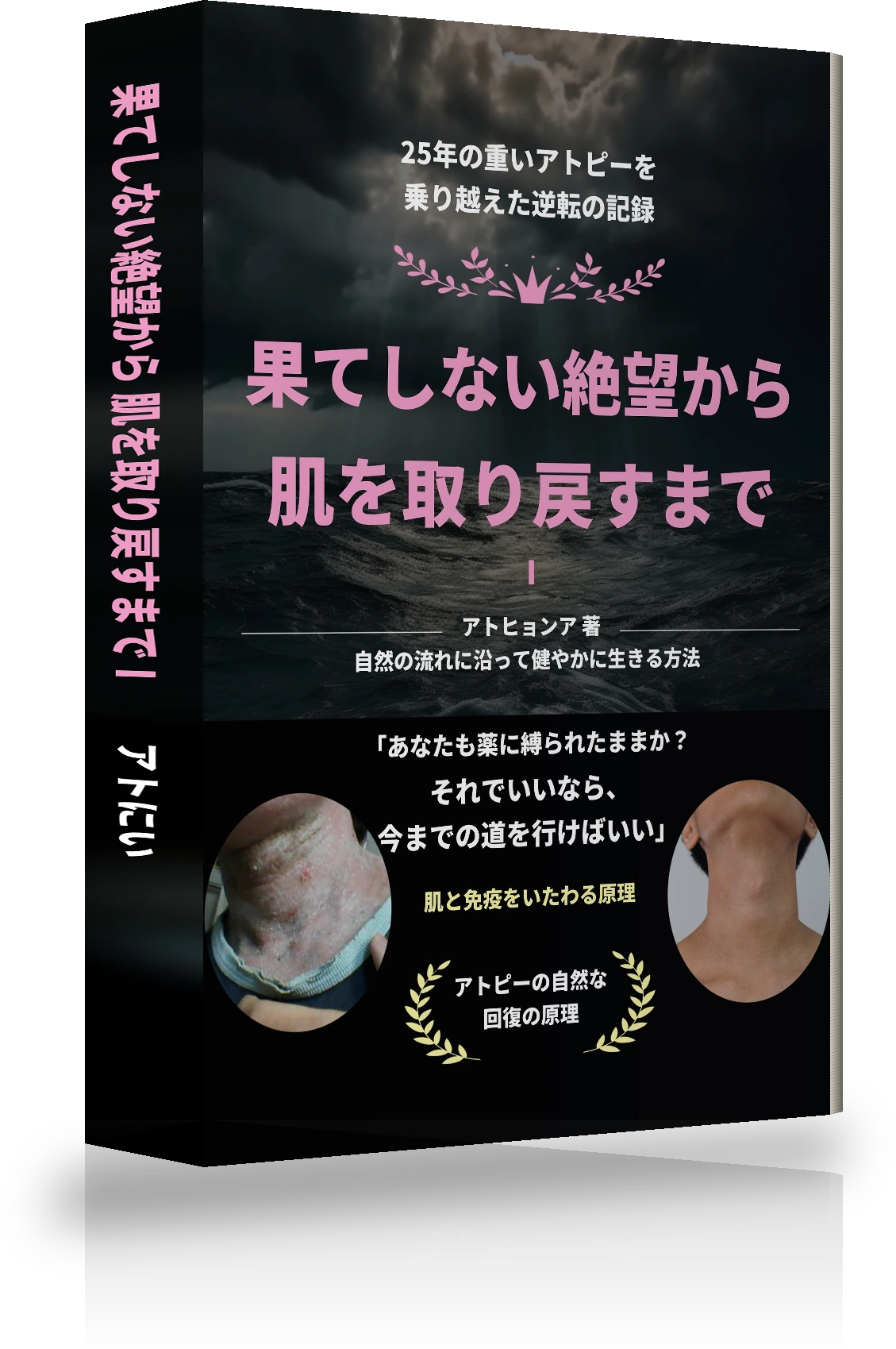 「果てなき絶望からアトピー完治まで Ⅰ」の表紙