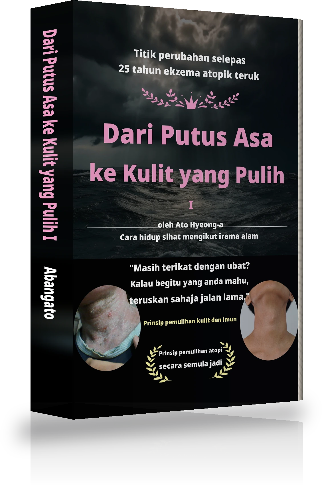 Kulit buku Dari Putus Asa Tanpa Penghujung kepada Kesembuhan Sepenuhnya Atopi Ⅰ