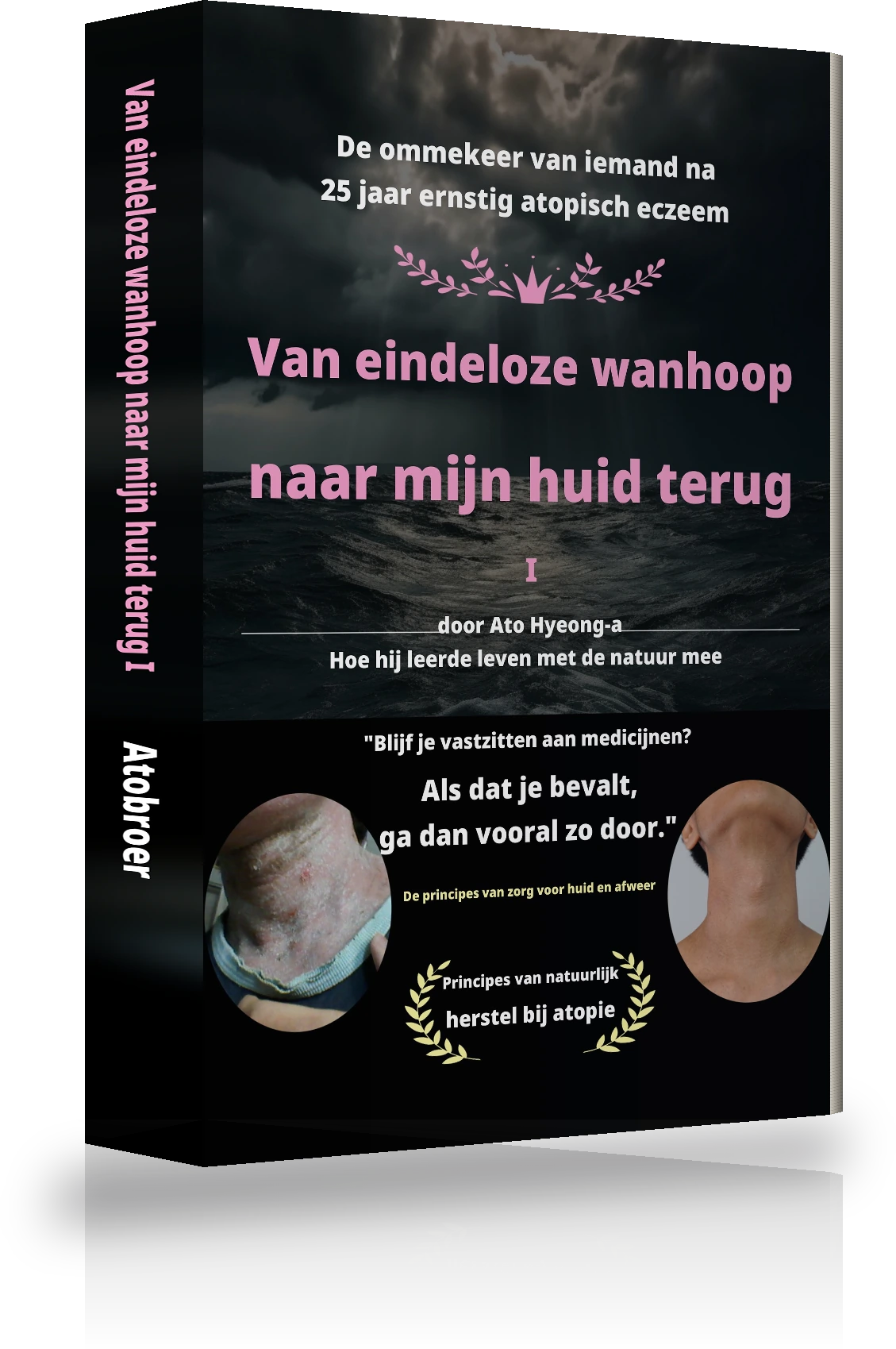 Cover van 'Van eindeloze wanhoop tot genezing van eczeem Ⅰ'