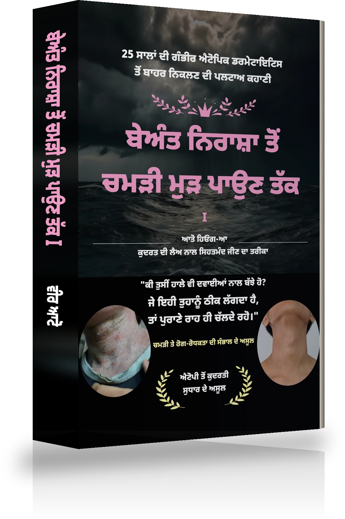ਬੇਅੰਤ ਨਿਰਾਸ਼ਾ ਤੋਂ ਐਟੋਪੀ ਦੇ ਪੂਰੇ ਇਲਾਜ ਤੱਕ Ⅰ ਦਾ ਕਵਰ