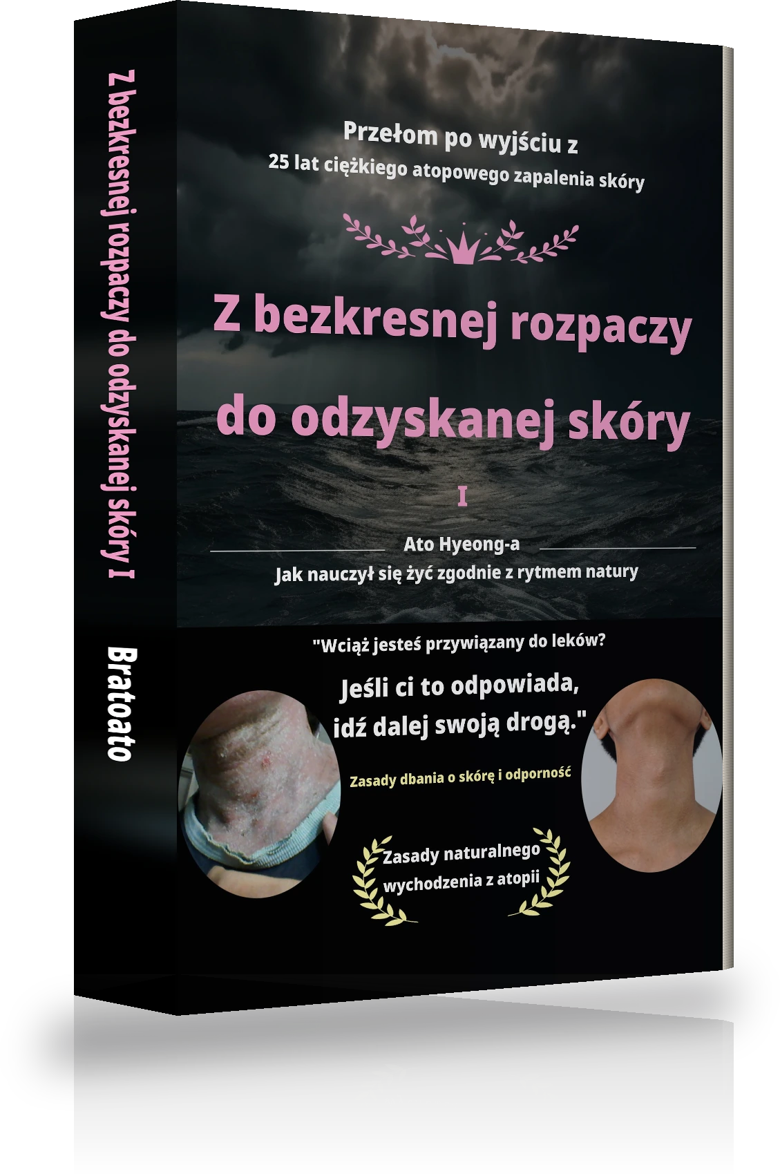 Okładka „Od niekończącej się rozpaczy do wyleczenia z atopii Ⅰ”