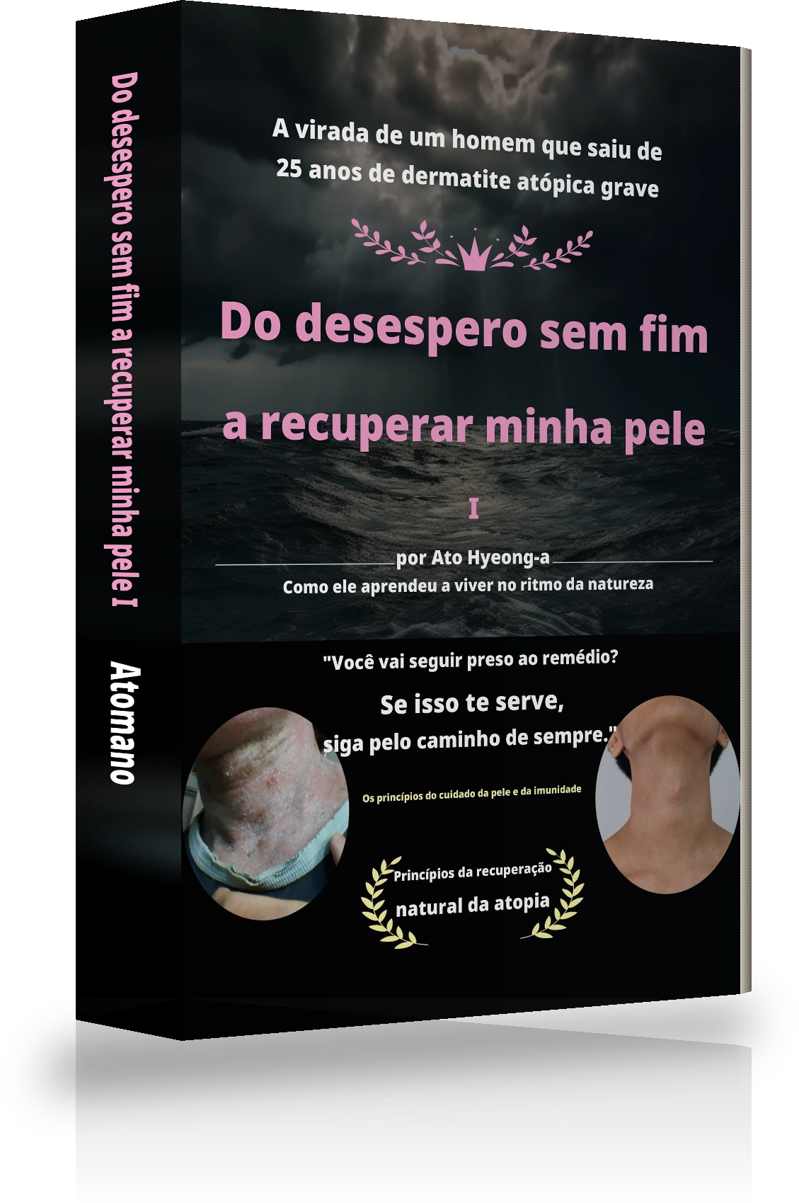 Capa de «Do desespero sem fim à cura da atopia Ⅰ»