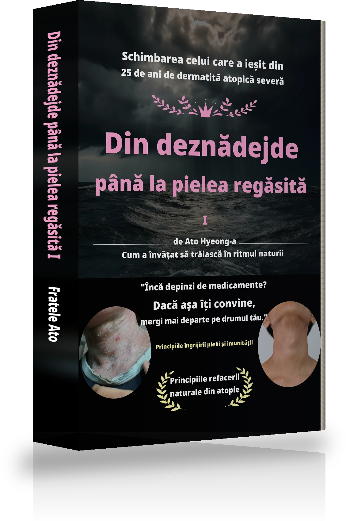 Coperta „Din disperarea fără sfârșit până la vindecarea completă a atopiei Ⅰ”