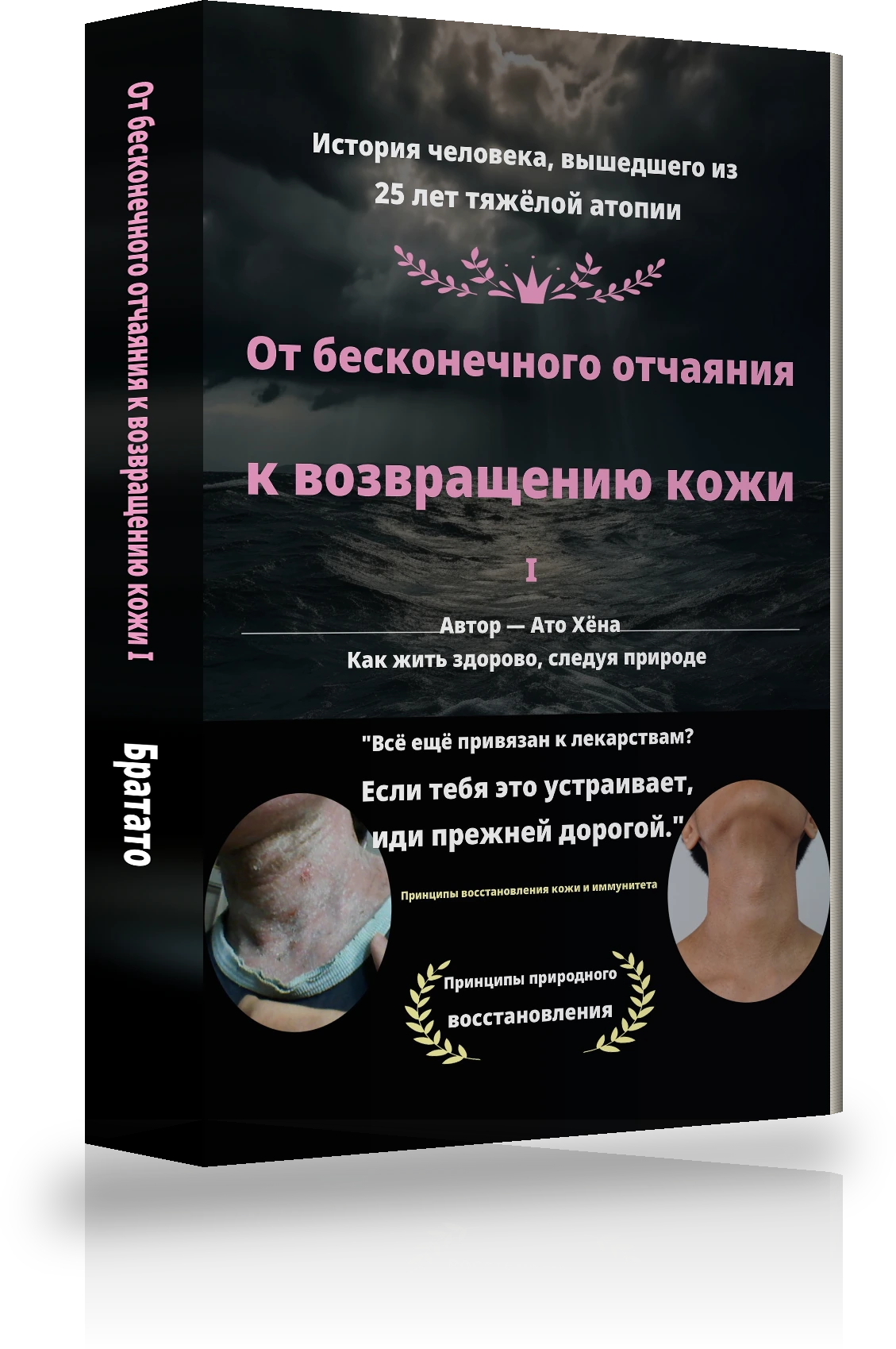 Обложка «От бесконечного отчаяния до исцеления от атопии Ⅰ»