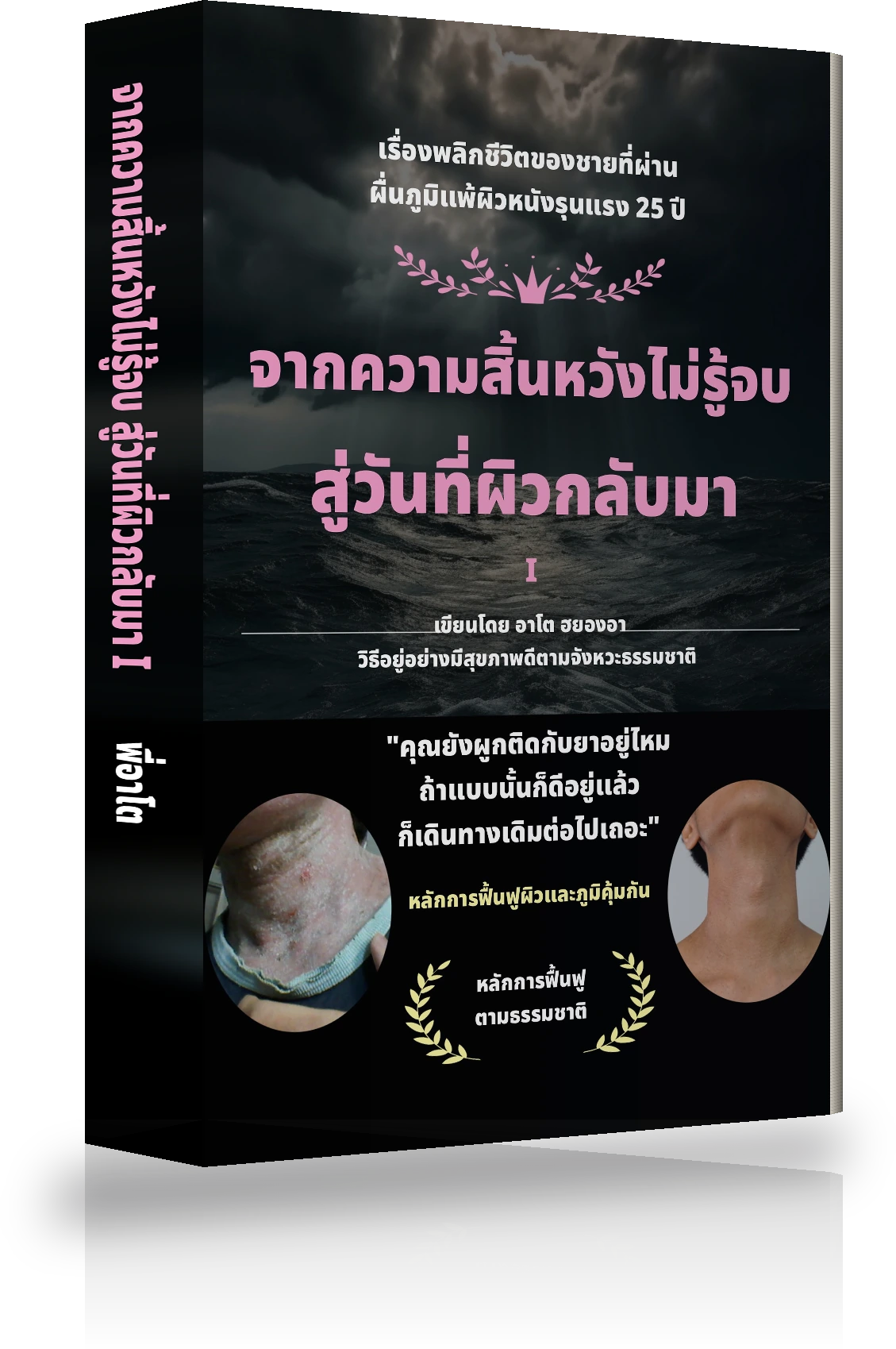 ปกหนังสือ จากความสิ้นหวังไม่รู้จบ สู่การหายขาดจากภูมิแพ้ผิวหนัง Ⅰ