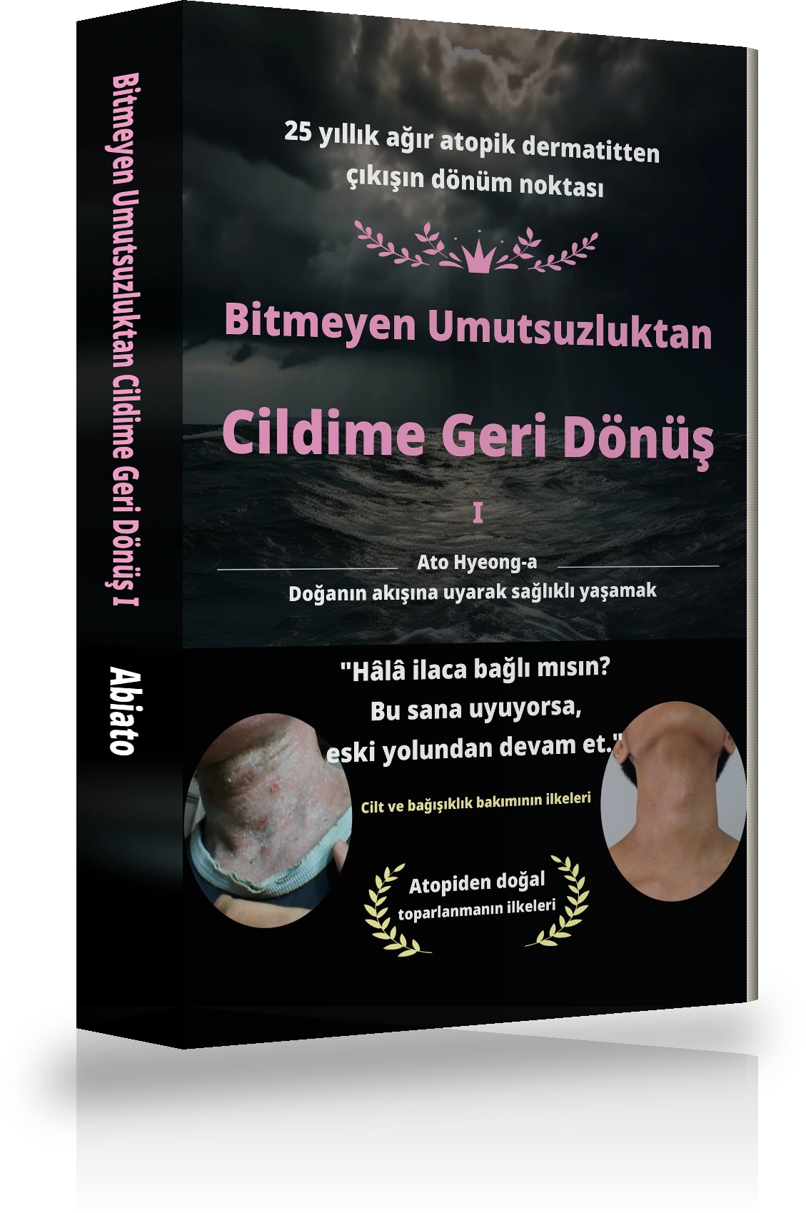 Sonsuz Umutsuzluktan Atopik Dermatitte Tam İyileşmeye Ⅰ — kapak
