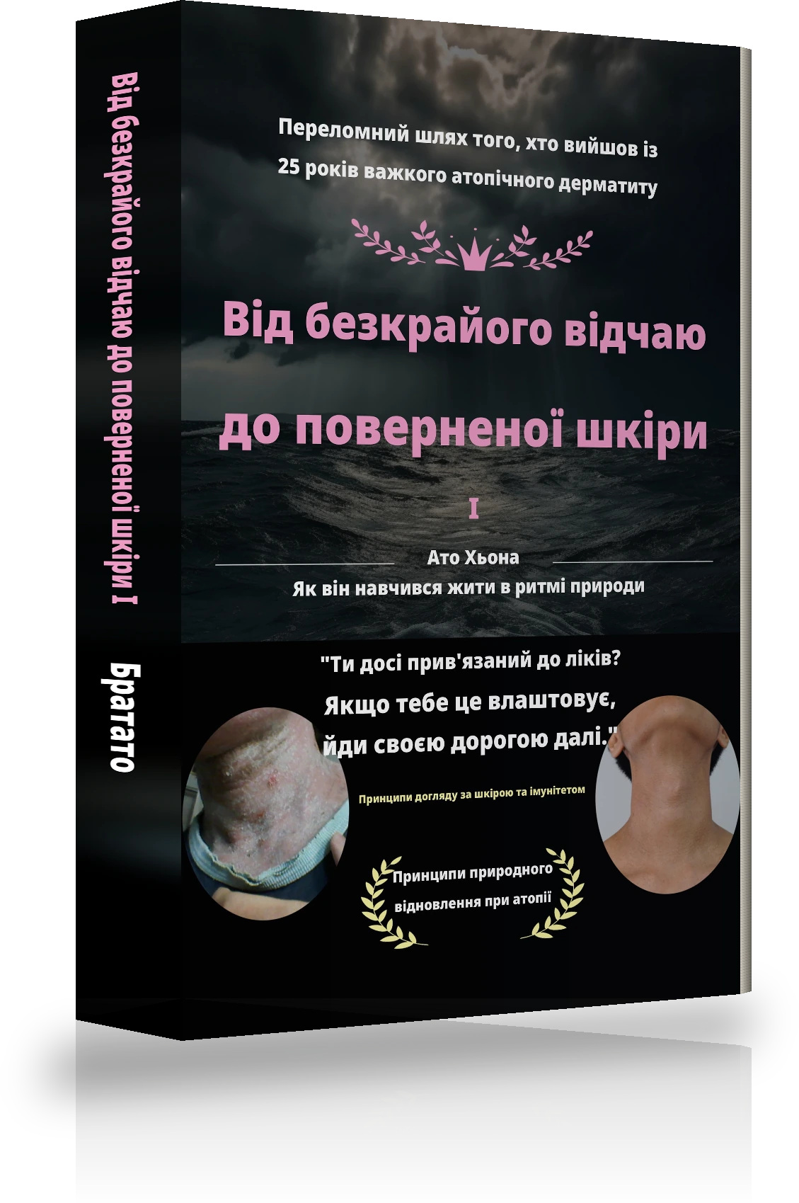 Обкладинка «Від нескінченного відчаю до подолання атопії Ⅰ»