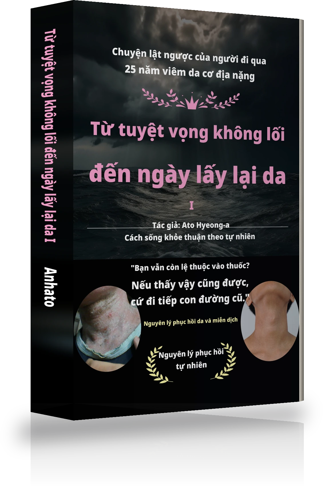 Bìa Từ tuyệt vọng vô tận đến khỏi hẳn atopy Ⅰ