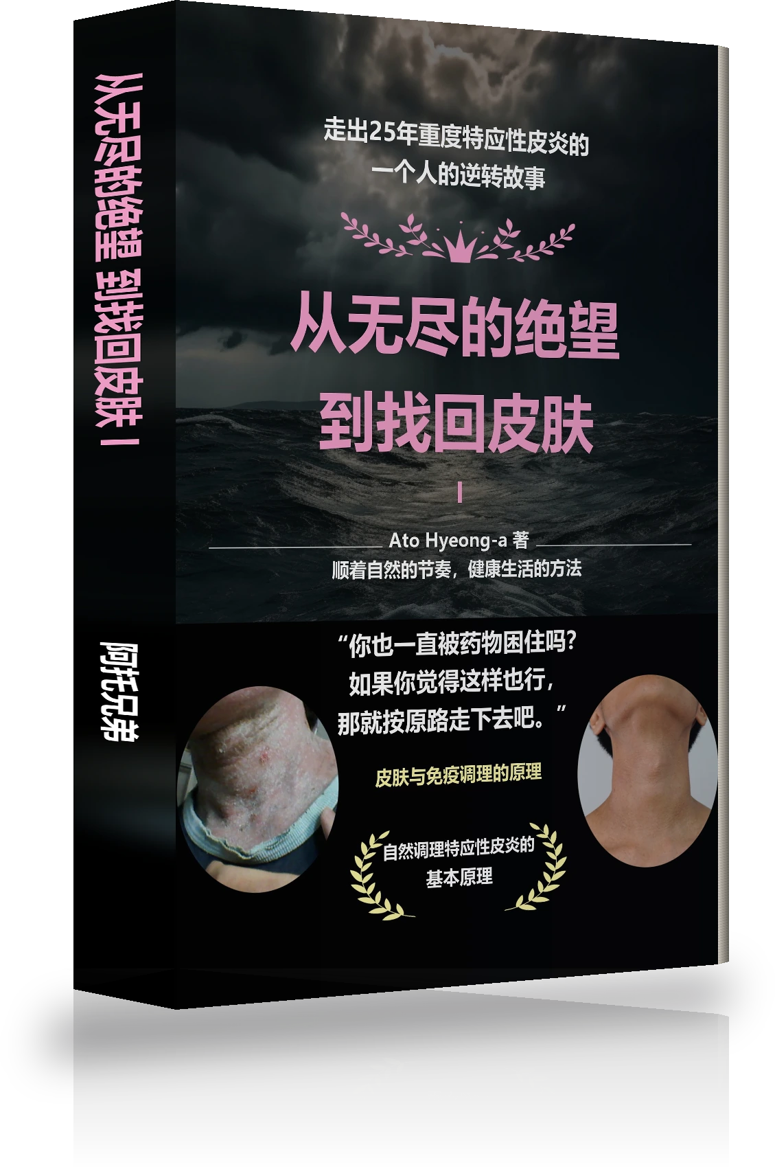 从无尽的绝望到治愈特应性皮炎 Ⅰ 封面
