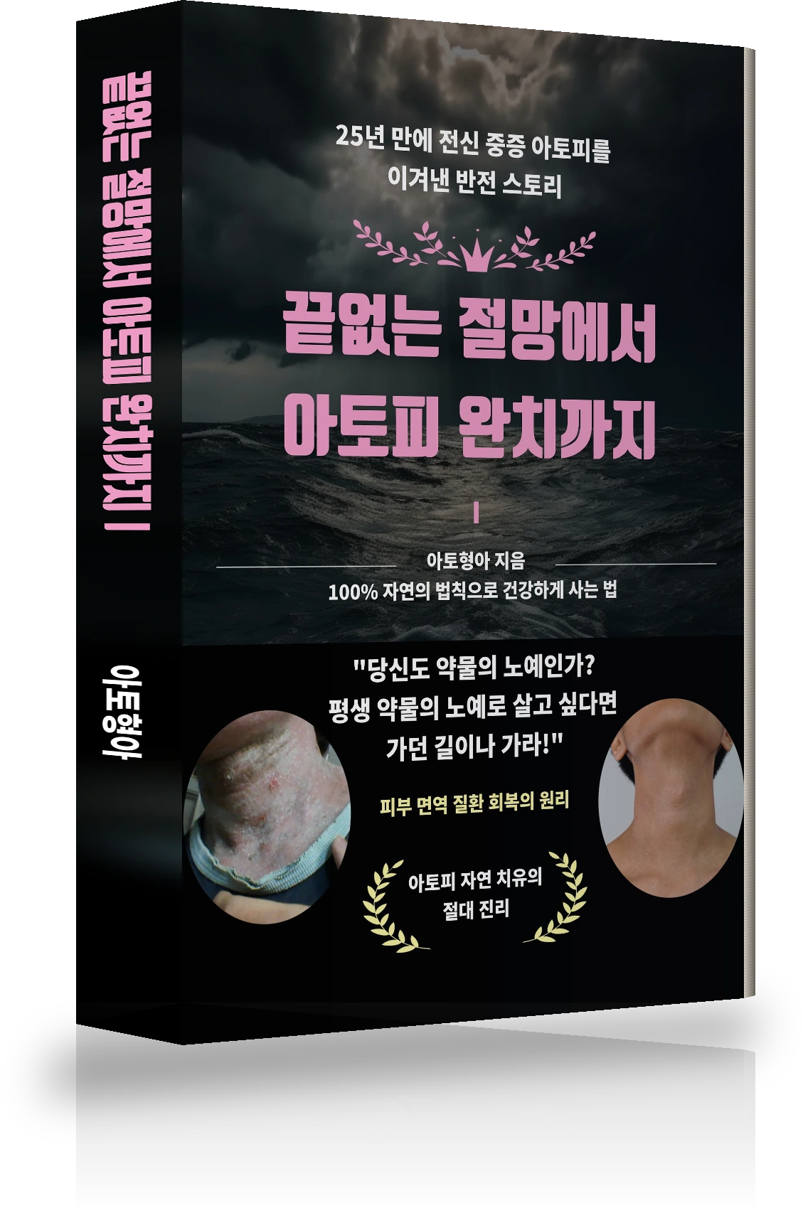 끝없는 절망에서 아토피 완치까지 Ⅰ 표지