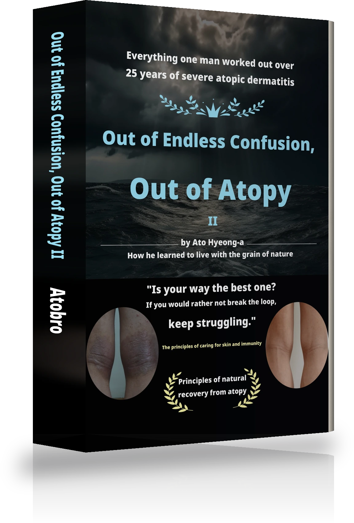 Cover of Out of Endless Confusion, Out of Atopy Ⅱ