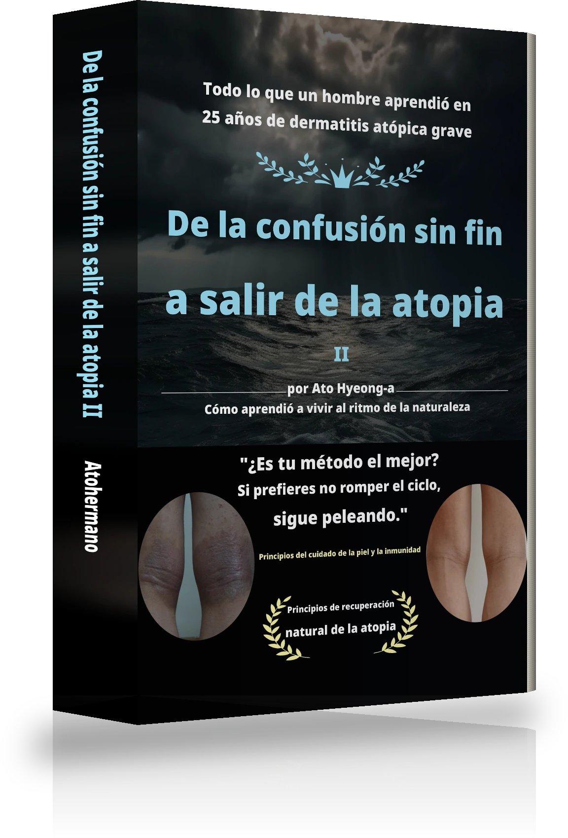 Portada de «De la confusión sin fin a librarse de la atopia Ⅱ»