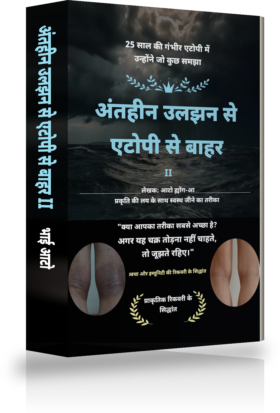 अंतहीन उलझन से एटोपी से मुक्ति Ⅱ का कवर