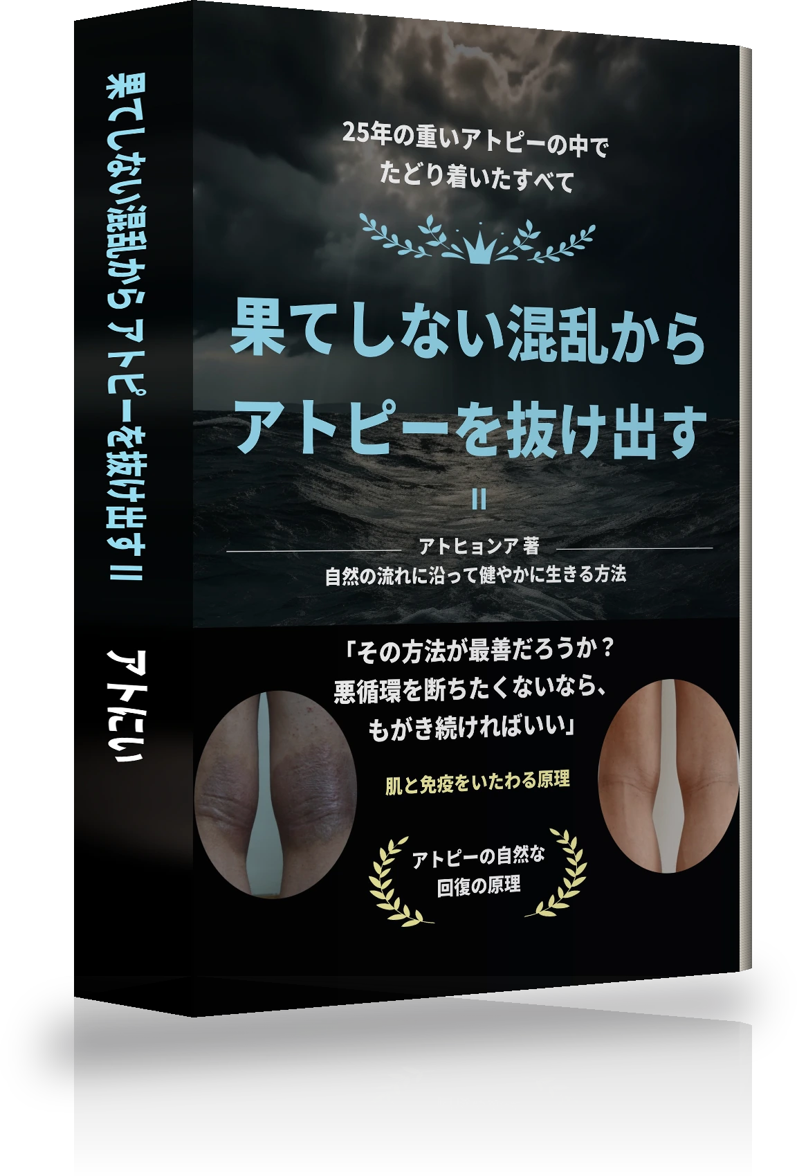 「果てなき混乱からアトピー脱出 Ⅱ」の表紙