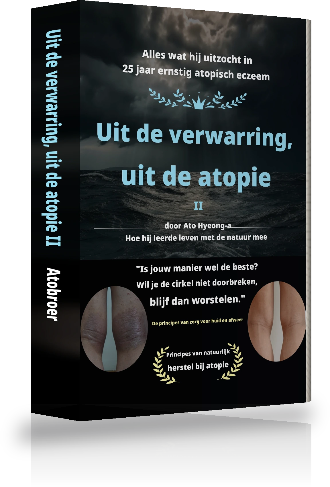 Cover van 'Uit eindeloze verwarring bevrijd van eczeem Ⅱ'