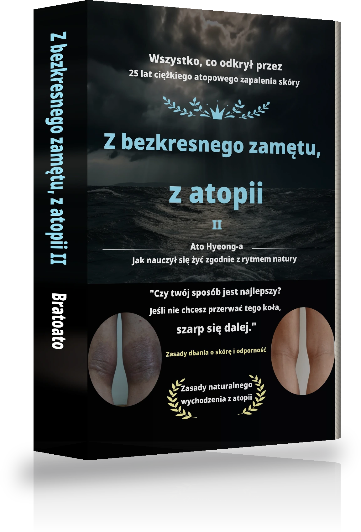 Okładka „Od niekończącego się zamętu do uwolnienia od atopii Ⅱ”