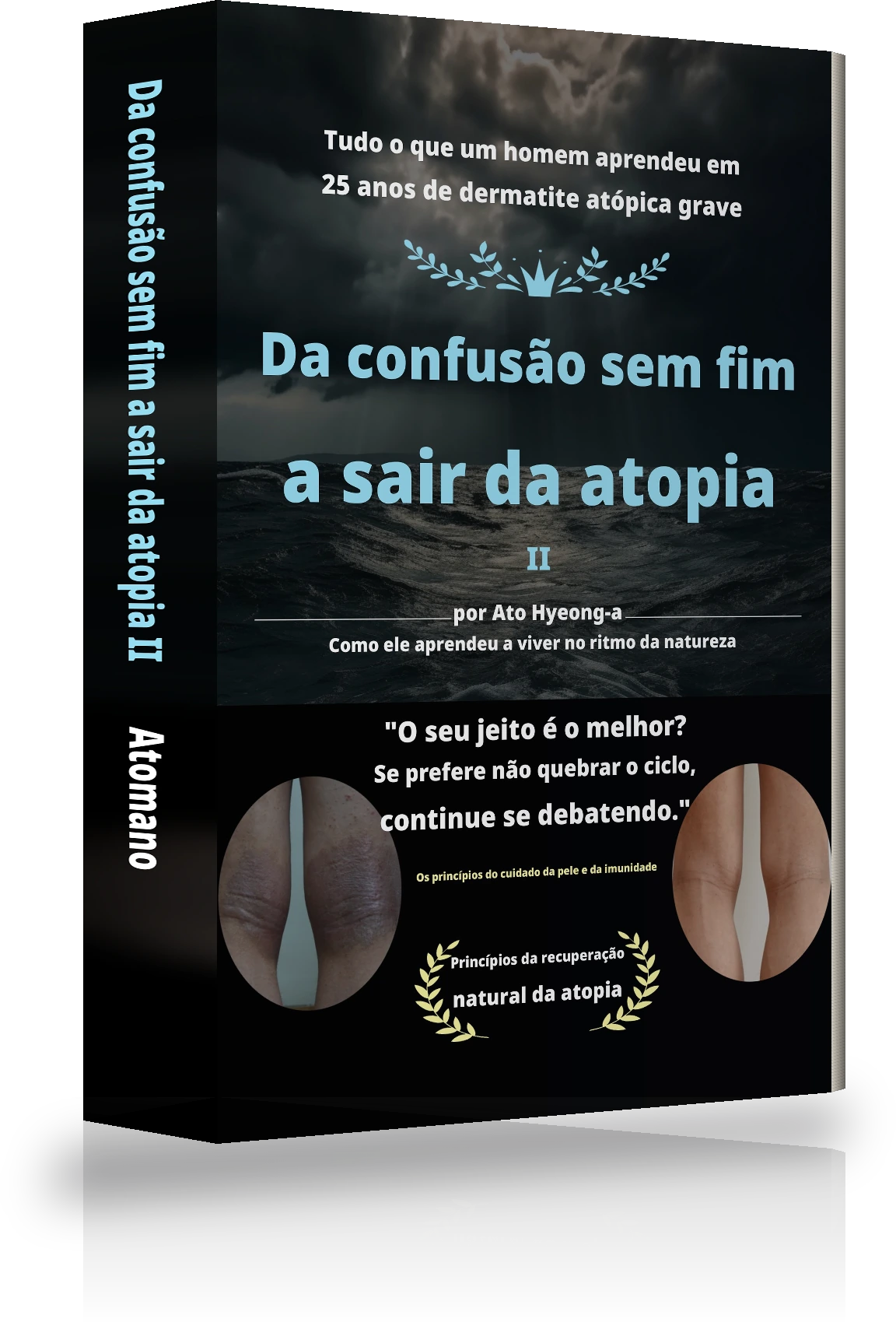 Capa de «Da confusão sem fim ao livrar-se da atopia Ⅱ»