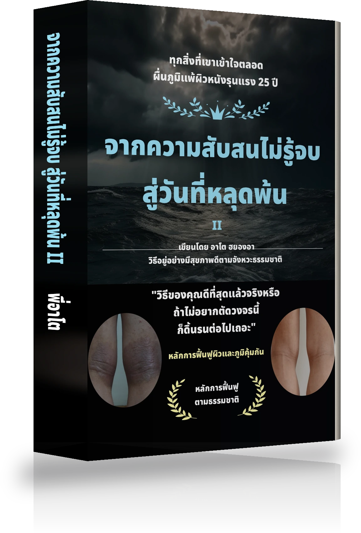 ปกหนังสือ จากความสับสนไม่รู้จบ สู่การหลุดพ้นจากภูมิแพ้ผิวหนัง Ⅱ