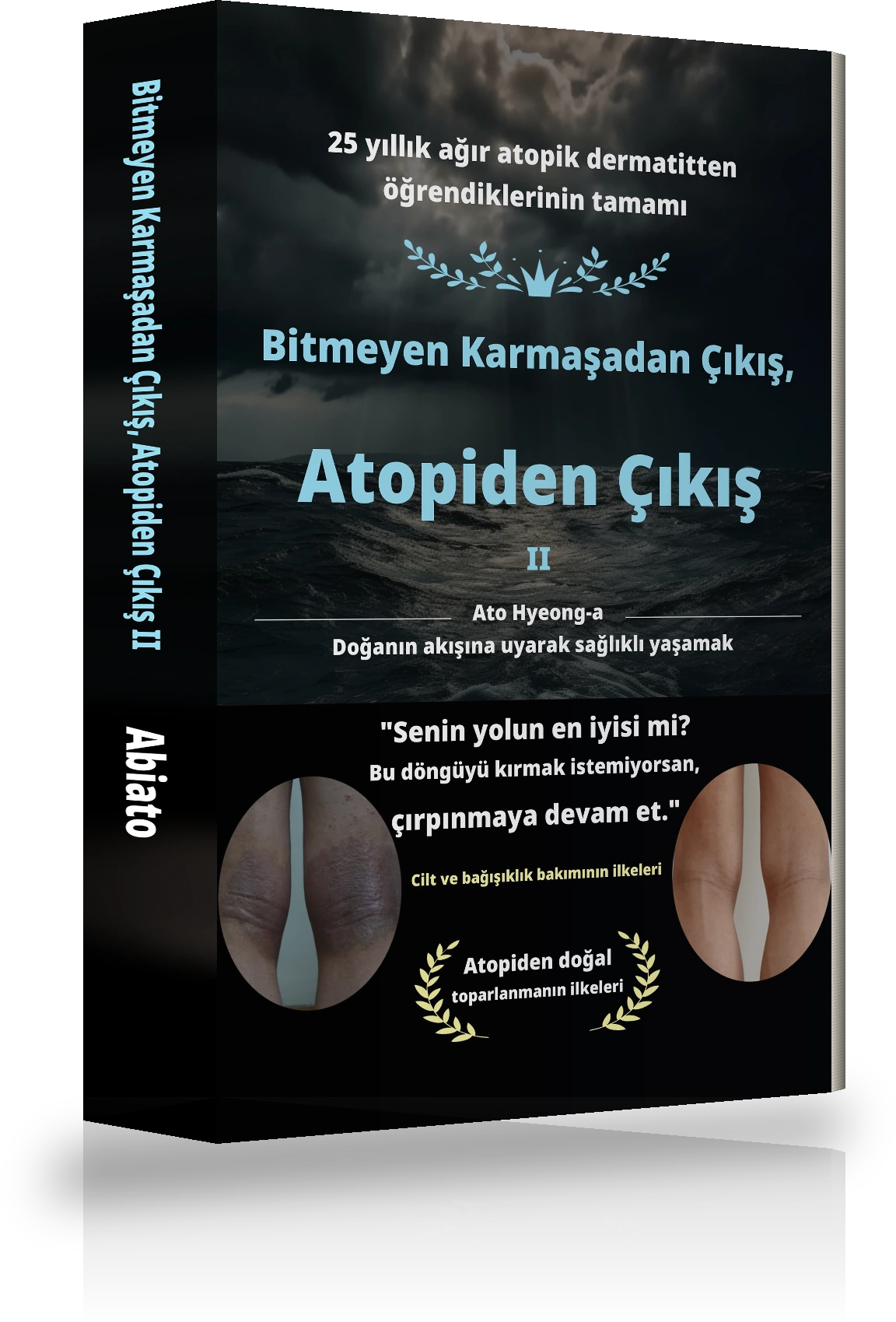 Sonsuz Kafa Karışıklığından Atopik Dermatitten Kurtuluşa Ⅱ — kapak