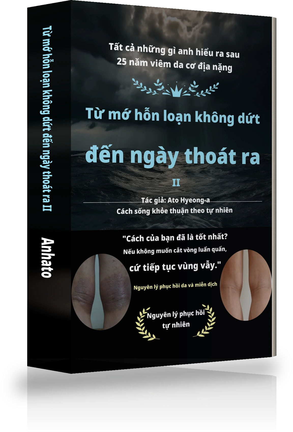 Bìa Từ hỗn loạn vô tận đến thoát khỏi atopy Ⅱ