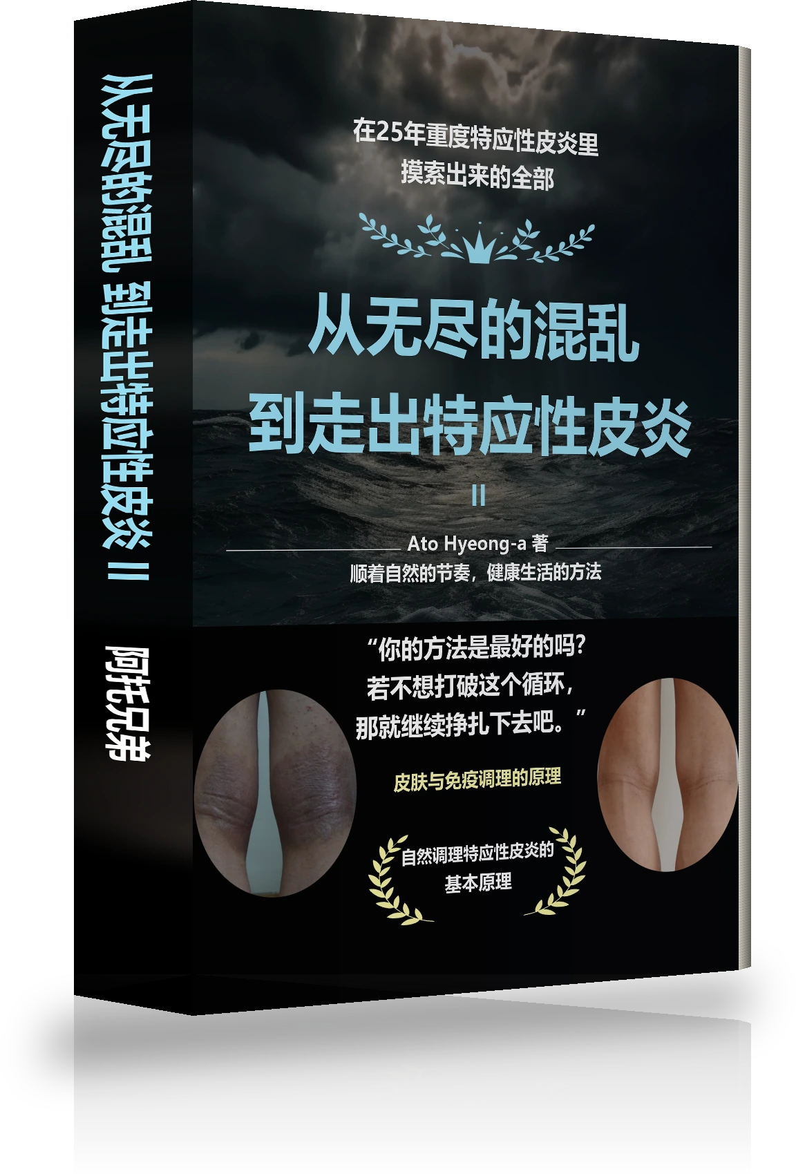 从无尽的混乱到摆脱特应性皮炎 Ⅱ 封面