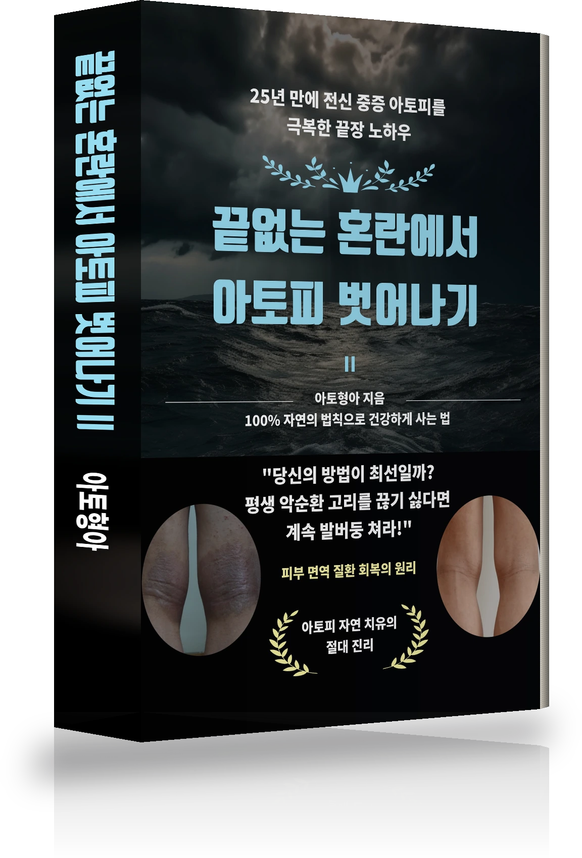끝없는 혼란에서 아토피 벗어나기 Ⅱ 표지